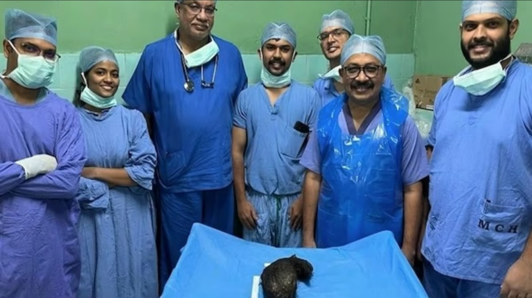 15കാരിയുടെ വയറ്റിൽ രണ്ട് കിലോ മുടിക്കെട്ട്