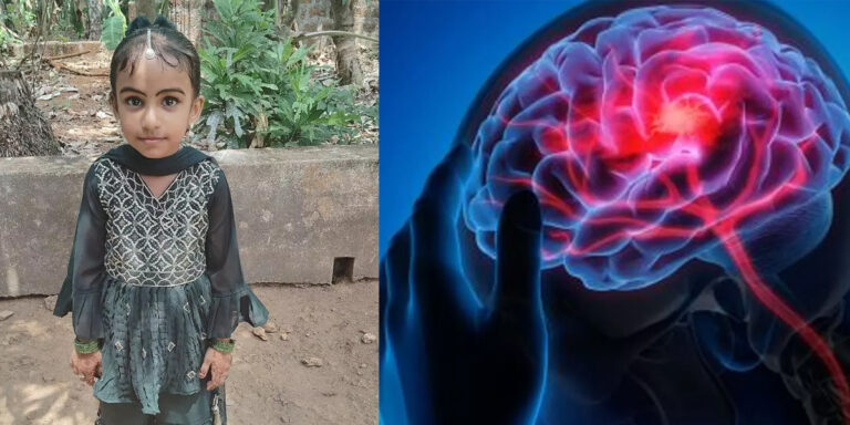അമീബിക് മസ്തിഷ്ക ജ്വരം:   ചികിത്സയിൽ കഴിഞ്ഞിരുന്ന അഞ്ച് വയസുകാരി മരിച്ചു