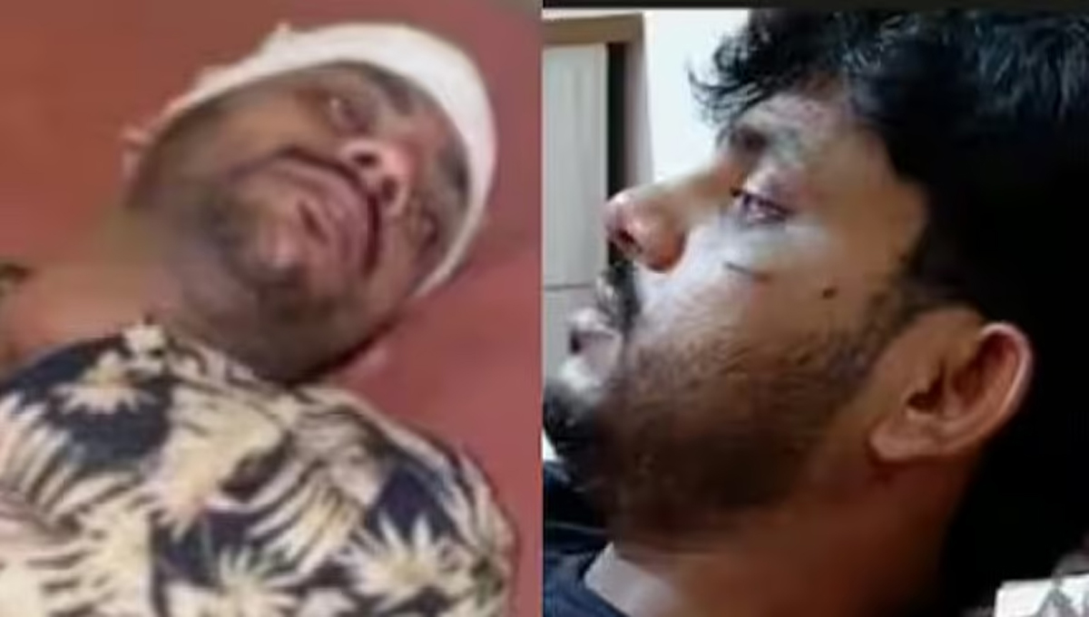 കോഴിക്കോട് യുവാവിനെ തട്ടിക്കൊണ്ടുപോയി മര്‍ദിച്ചു; മാര്‍ക്കറ്റിങ് ഏജന്‍സി ഉടമക്കെതിരെ പരാതി