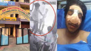 പാലക്കാട് സഹപാഠിയുടെ മര്‍ദ്ദനത്തില്‍ മൂക്കിന്റെ പാലം തകര്‍ന്ന വിദ്യാര്‍ത്ഥിയുടെ നില ഗുരുതരം