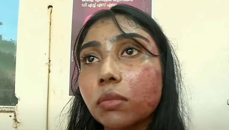 വഞ്ചിയൂരില്‍ വനിത അഭിഭാഷകയ്ക്ക് ക്രൂരമര്‍ദ്ദനം