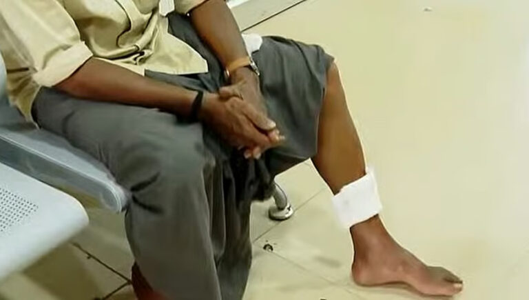 കണ്ണൂരില്‍ വീണ്ടും തെരുവ് നായ ആക്രമണം; 11 പേര്‍ക്ക് കടിയേറ്റു