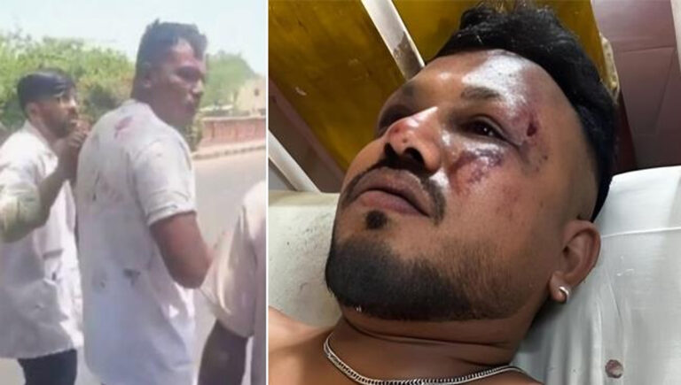 അതിജീവനം : അഹമ്മദാബാദ് വിമാന അപകടത്തില്‍ നിന്നും ഒരാള്‍ അദ്ഭുതകരമായി രക്ഷപ്പെട്ടതായി റിപ്പോര്‍ട്ട്