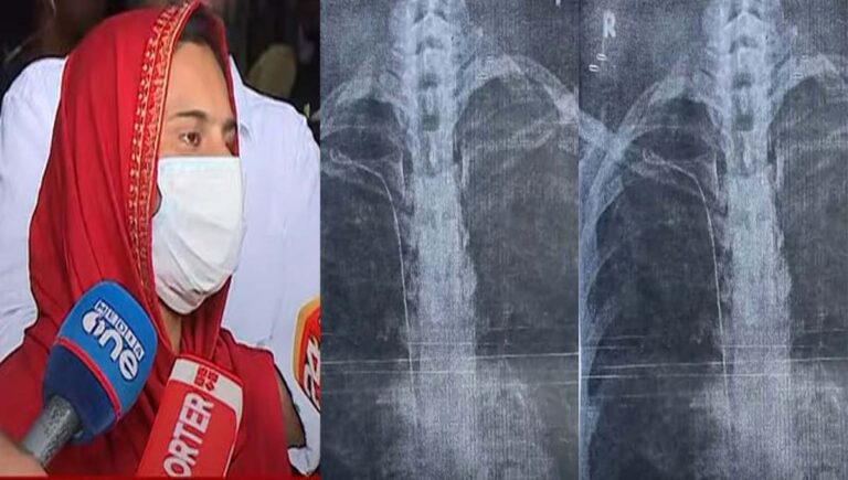 തിരുവനന്തപുരം ജനറല്‍ ആശുപത്രിയിലെ ശസ്ത്രക്രിയ പിഴവ്; സുമയ്യ സര്‍ക്കാരിനെതിരെ ഹൈക്കോടതിയിലേക്ക്