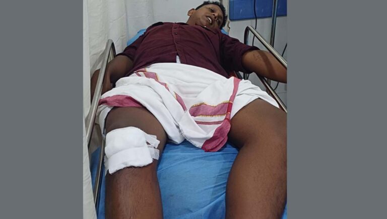 കണ്ണൂരിൽ എസ് എഫ് ഐ നേതാവിന് കുത്തേറ്റു