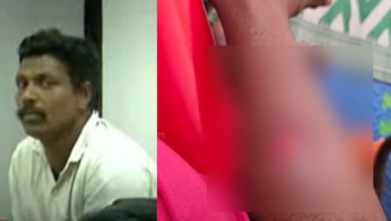 കൊല്ലത്ത് കുട്ടി വികൃതി കാട്ടിയതിന് രണ്ടാനച്ഛൻ കാലില്‍ ഇസ്തിരി പെട്ടികൊണ്ട് പൊള്ളിച്ചു