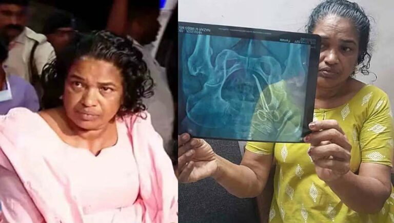 ആലപ്പുഴ മെഡിക്കൽ കോളജിലെ ശസ്ത്രക്രിയ പിഴവ്; ഡോക്ടർക്ക് വീഴ്ചയില്ലെന്ന് അന്വേഷണ റിപ്പോർട്ട്