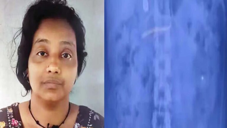 കോഴിക്കോട് മോഷ്ടിച്ച സ്വര്‍ണമാല വിഴുങ്ങിയ കേസ്; പ്രതി സമീന പൊലീസുകാരെ കബളിപ്പിച്ച് തൊണ്ടിമുതല്‍ ശുചിമുറിയില്‍ ഒഴുക്കി