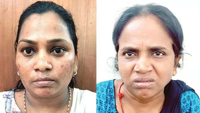 മൂവാറ്റുപുഴയില്‍ കിടപ്പുരോഗിയായ വീട്ടമ്മയുടെ ആഭരണം കവര്‍ന്ന കേസ്; ഹോം നഴ്‌സും സുഹൃത്തും അറസ്റ്റില്‍